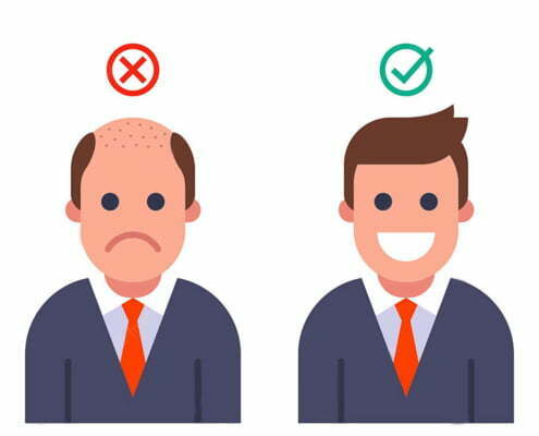 - دکتر حمید رضوانی کاشت مو