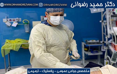 دکتر حمید رضوانی جراح ابدومینوپلاستی در تهران هستند