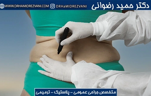 پیکر تراشی کل بدن چیست؟ و بهترین روش پیکر تراشی کدام است