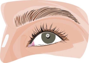 Eyebrow-transplantation کاشت ابرو