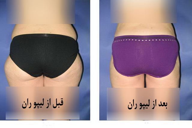 - دکتر حمید رضوانی -