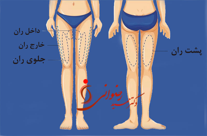 - دکتر حمید رضوانی -