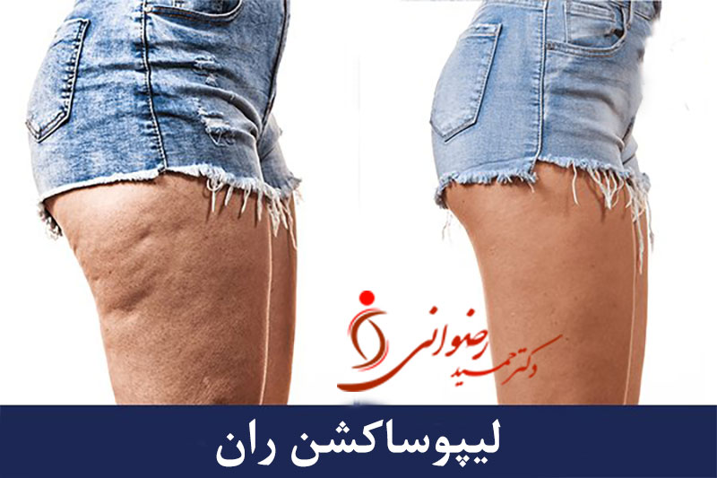 - دکتر حمید رضوانی -