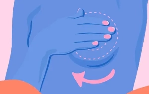 عمل ماستوپکسی جراحی لیفت سینه